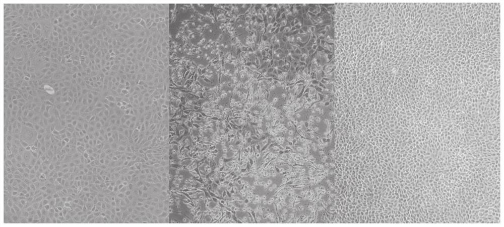 Application of saponin in preparation of anti-mycoplasma bovis product