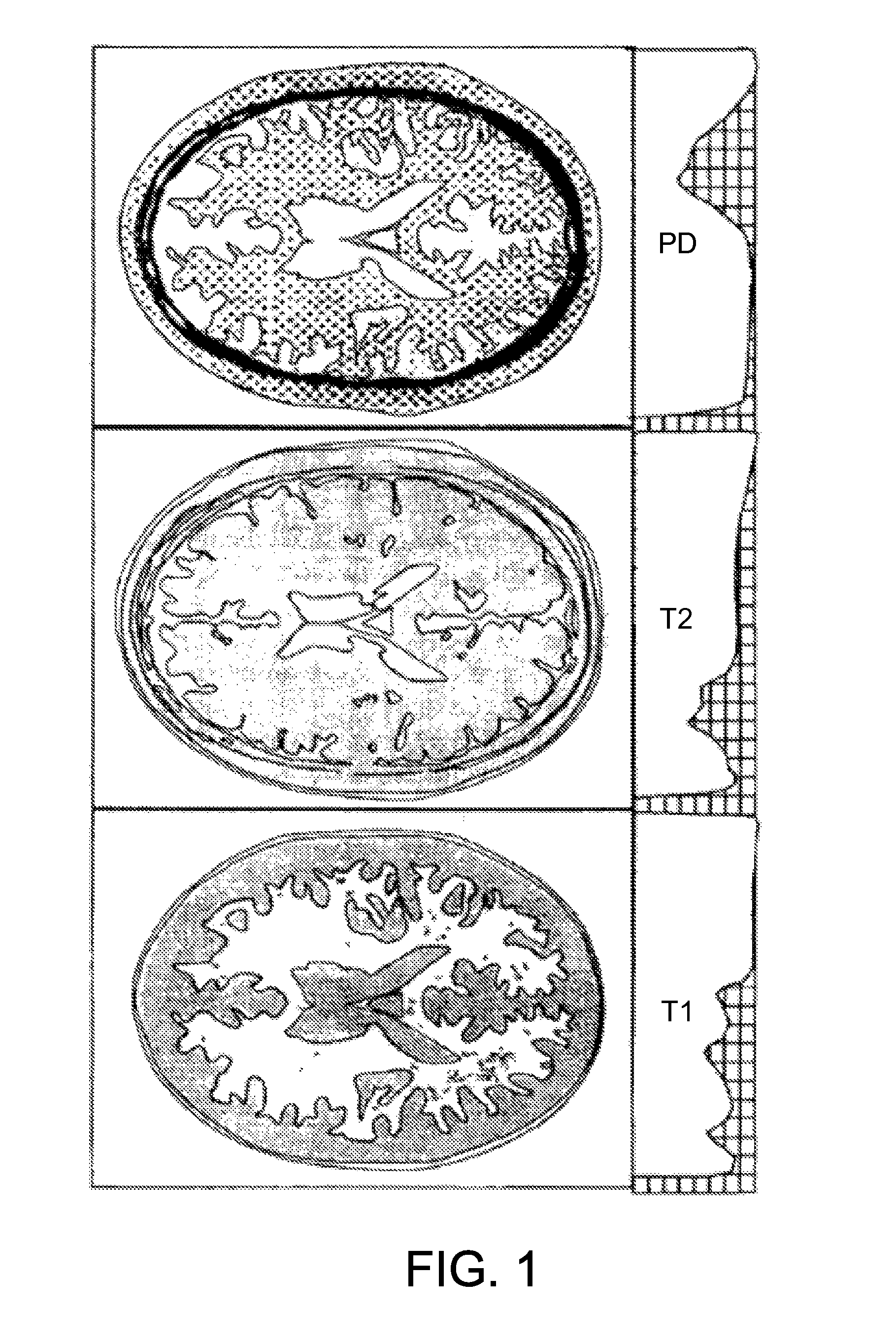 Neurocranial electrostimulation models, systems, devices, and methods