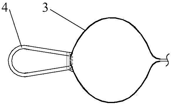 resected tissue extractor