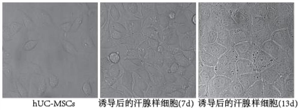 Induction medium and induction method for stem cell differentiation into sweat gland-like cells
