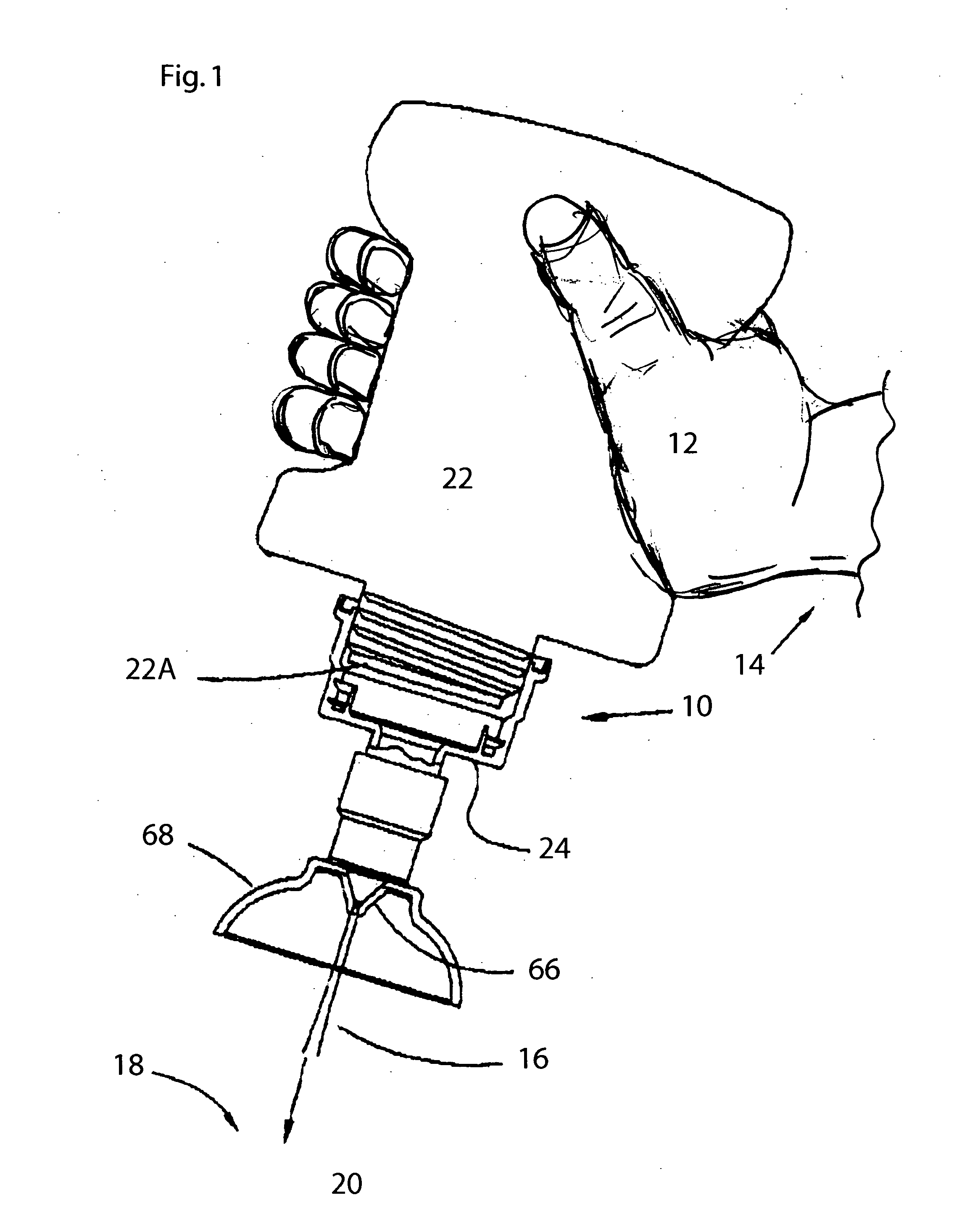Wound irrigation apparatus and method