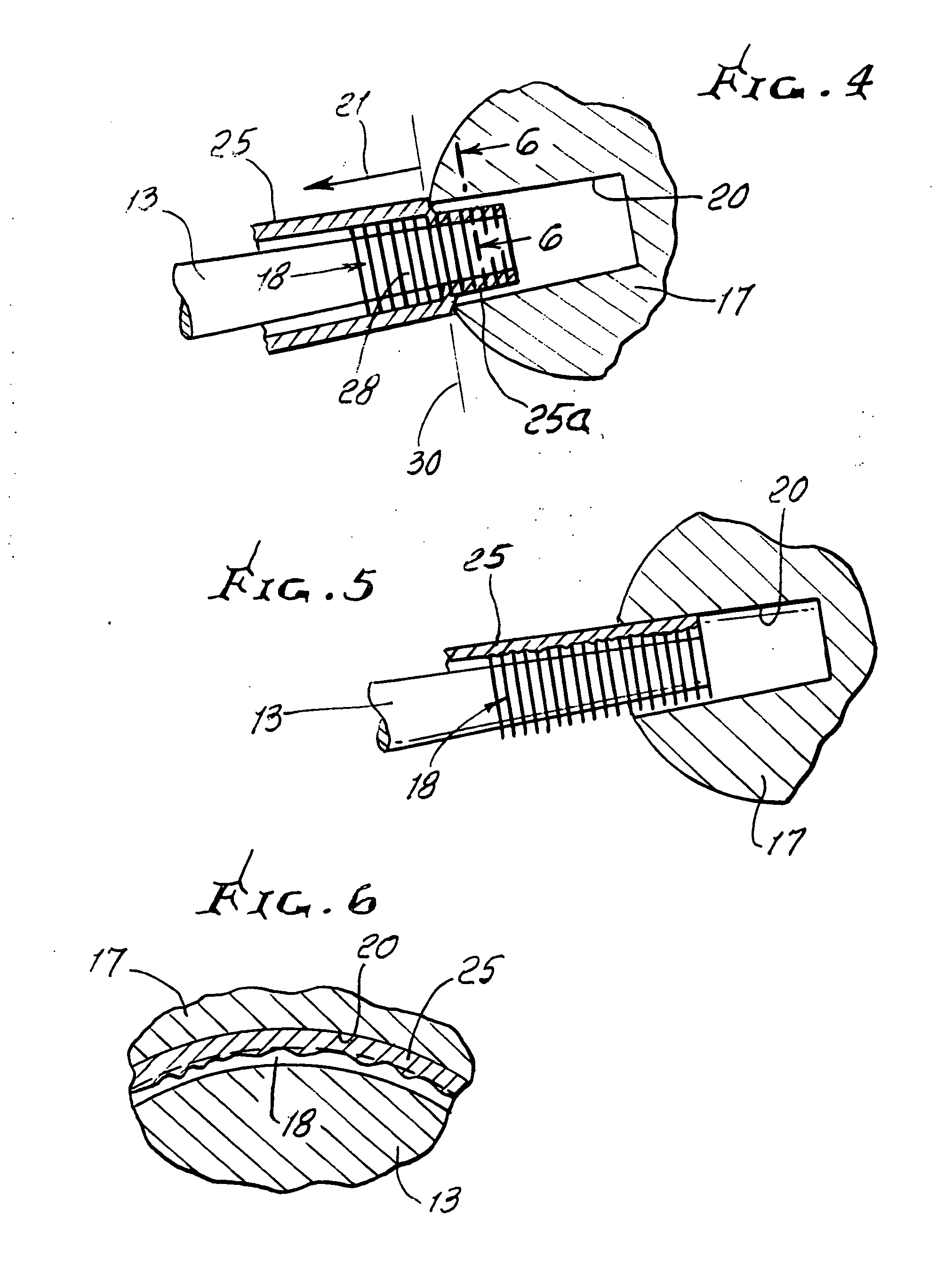 Hip surgery neck and ball adjustment apparatus and method
