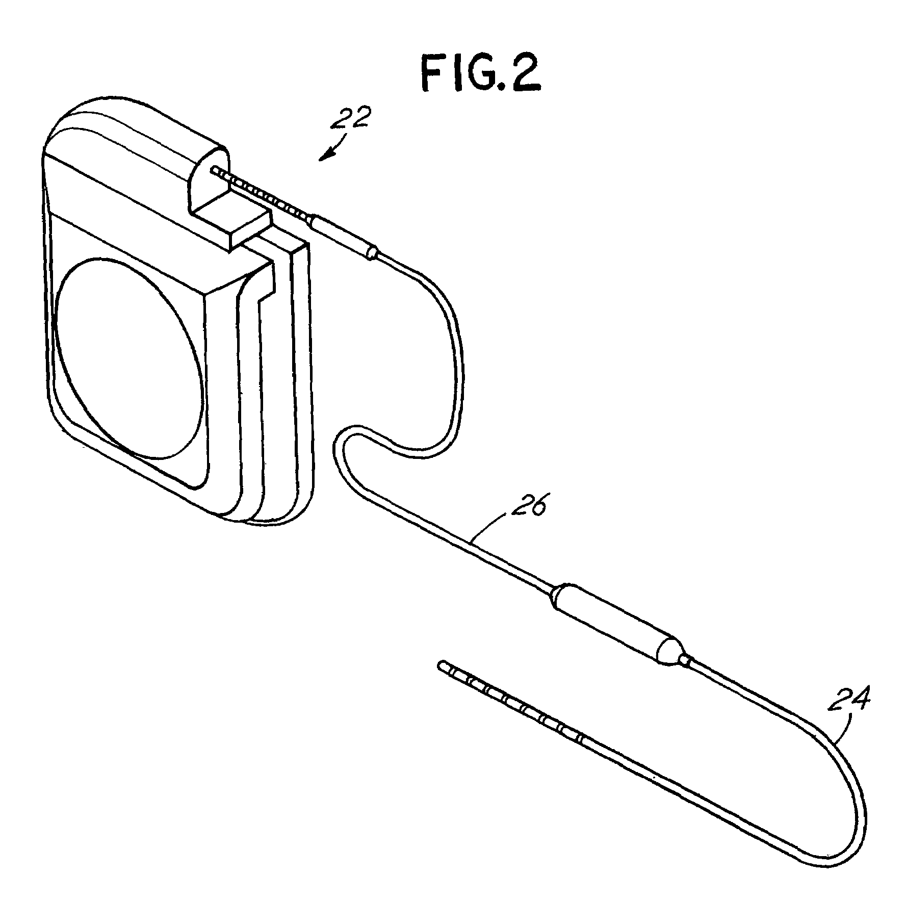 Method of operating an implantable medical device telemetry processor