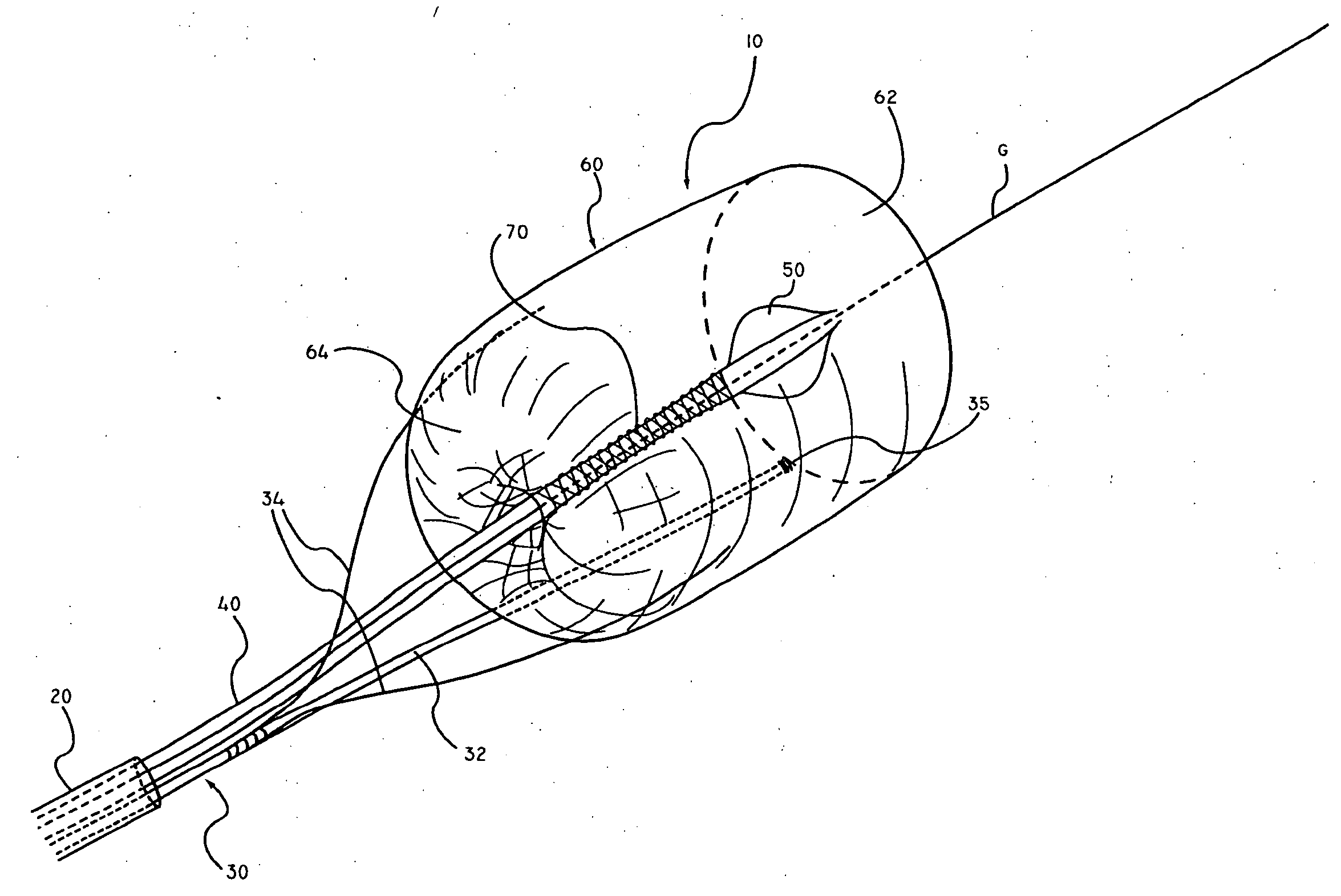 Apparatus and methods for intravascular embolic protection
