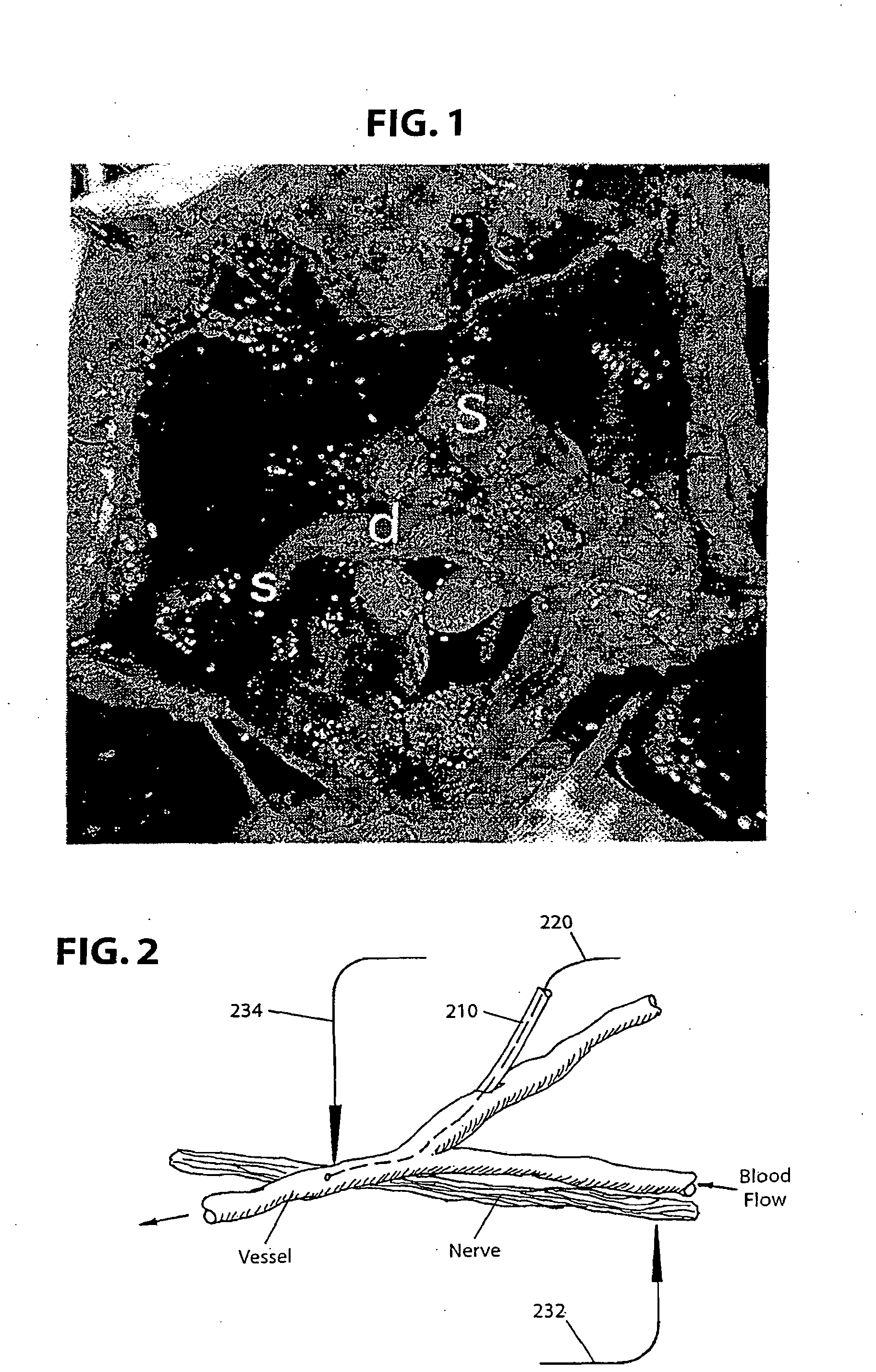 Brain- machine interface systems and methods