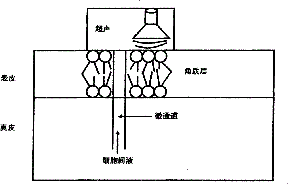 Rapid transdermal delivery system of local anesthetics