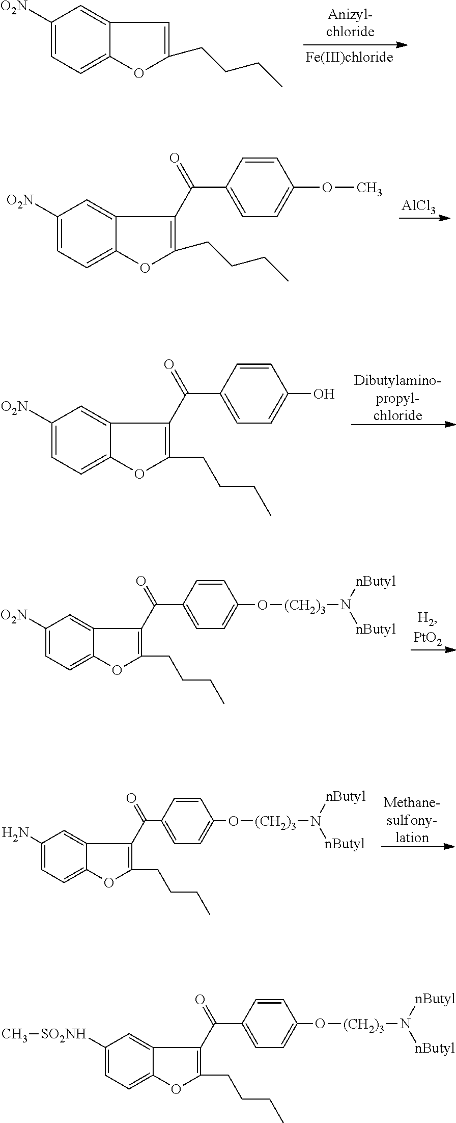 Process for preparation of dronedarone by removal of hydroxyl group