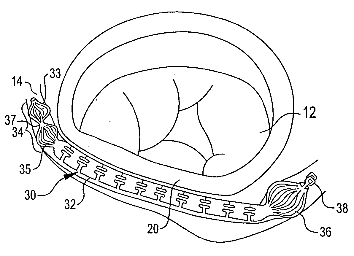 Device, assembly and method for mitral valve repair