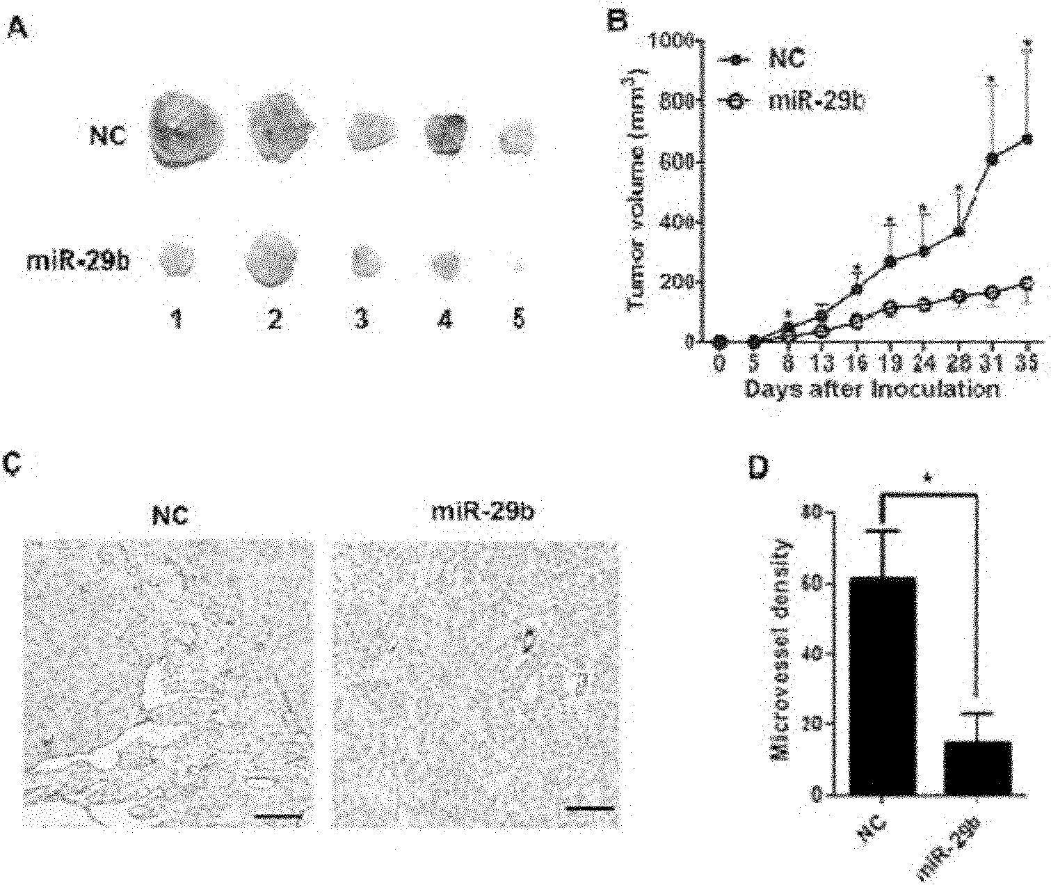 Small molecular non-coding RNA gene hsa-miR-29b and use thereof