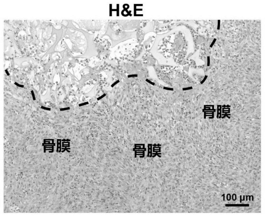 Bionic construction method of periosteum-like tissue