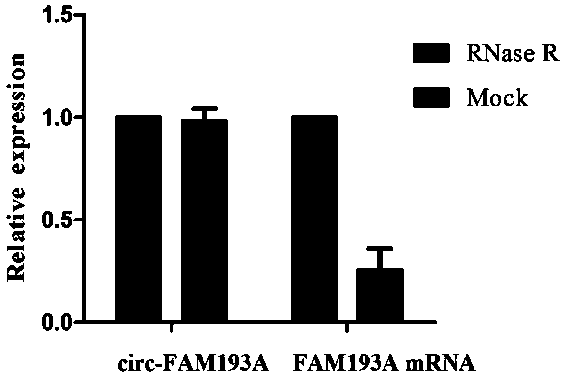Application of circ-FAM193A molecular marker in blood in diagnosis and prognosis of esophageal squamous carcinoma