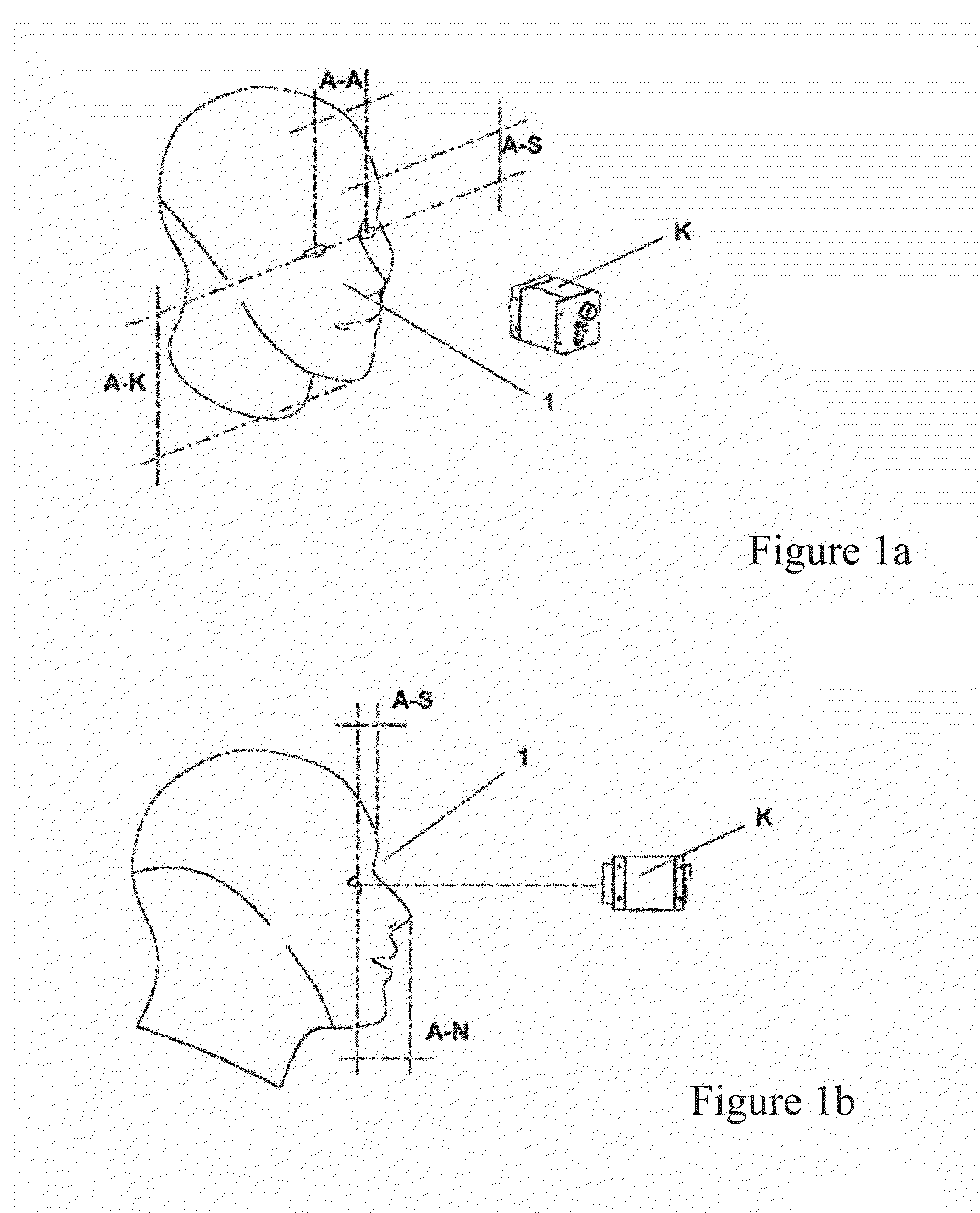 Assembly and method for the automatic rough positioning of ophthalmological equipment