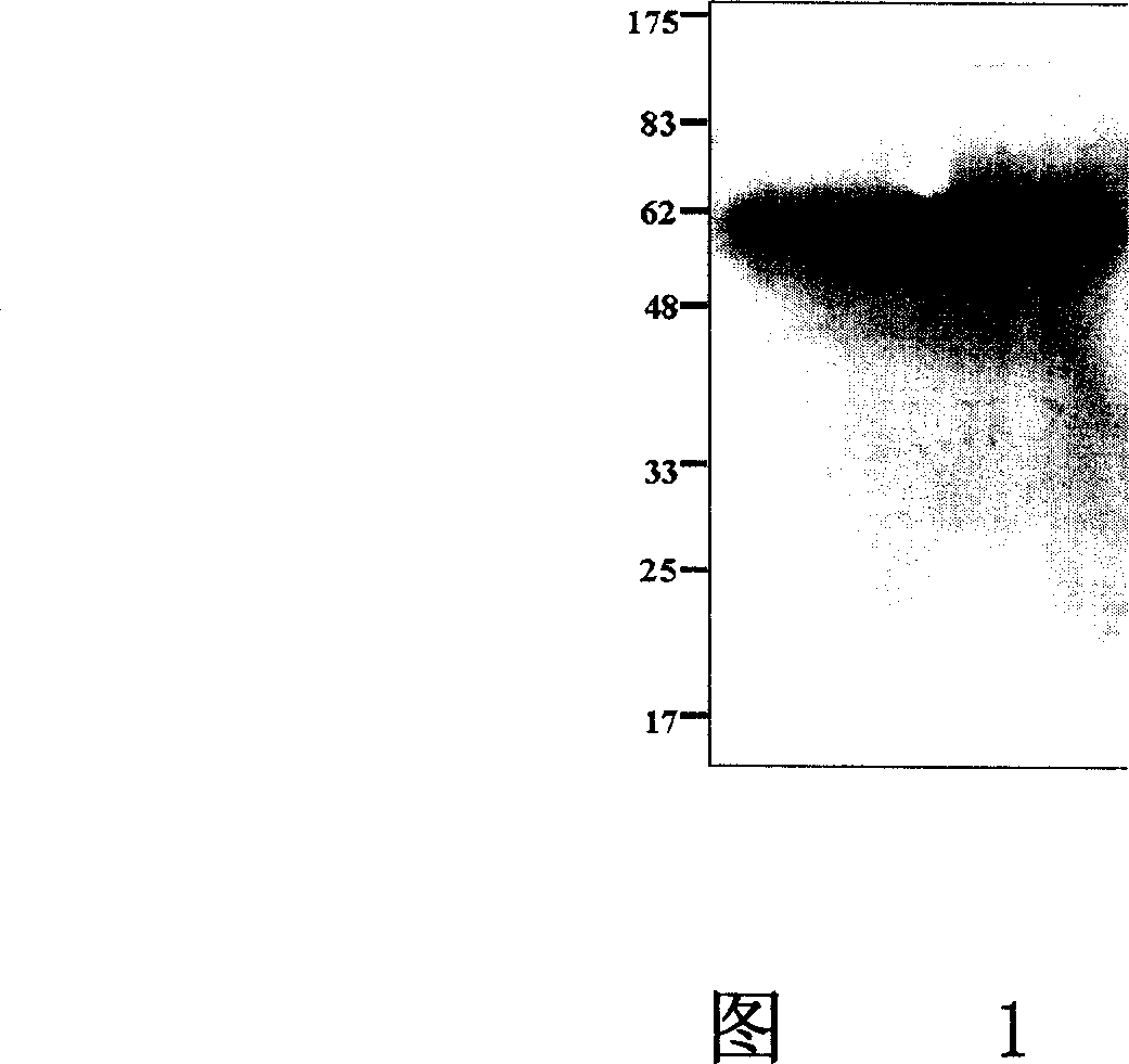 Important regulation albumen ChK2 of NF-KB signal path