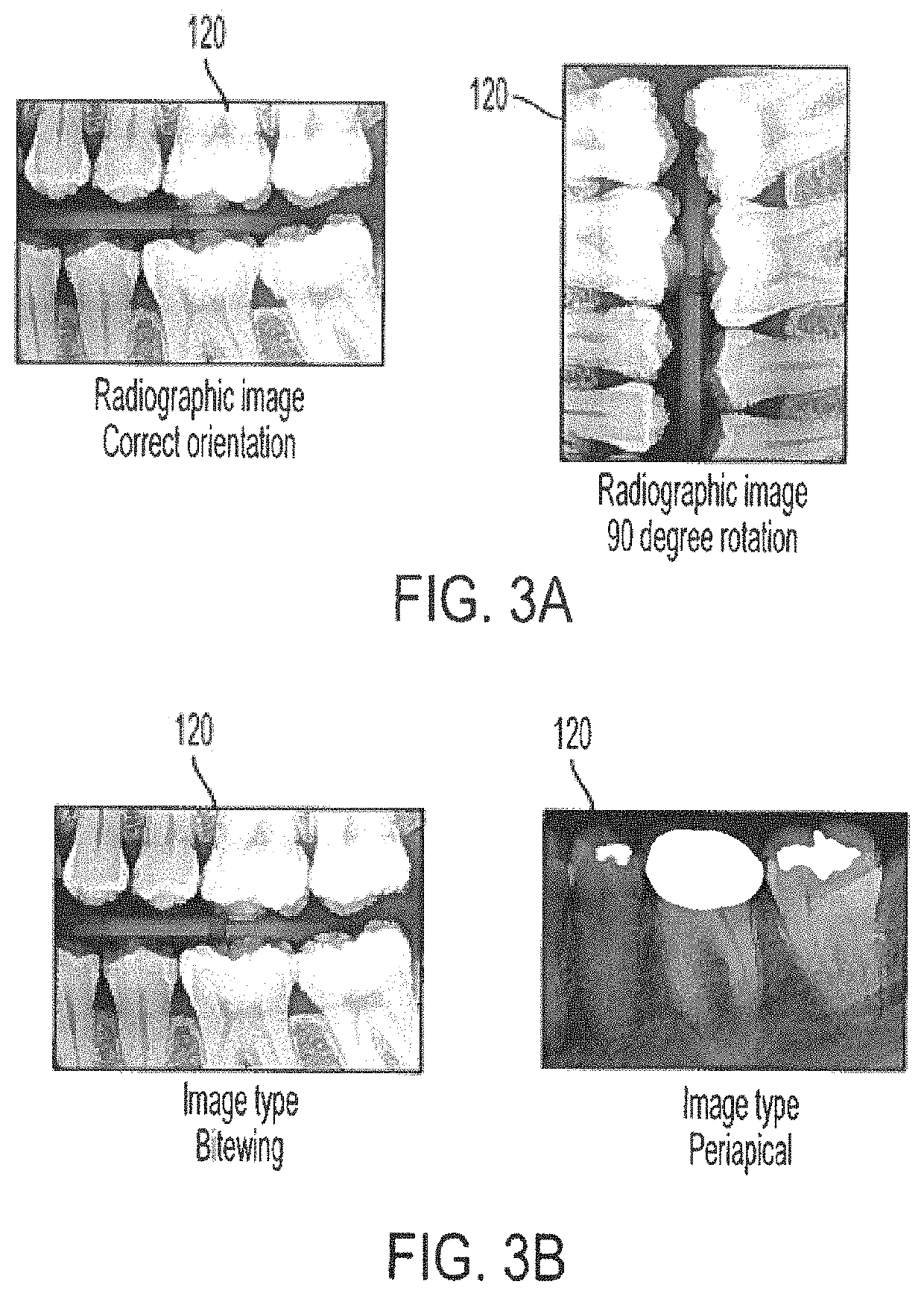 Estimating measurements of craniofacial structures in dental radiographs