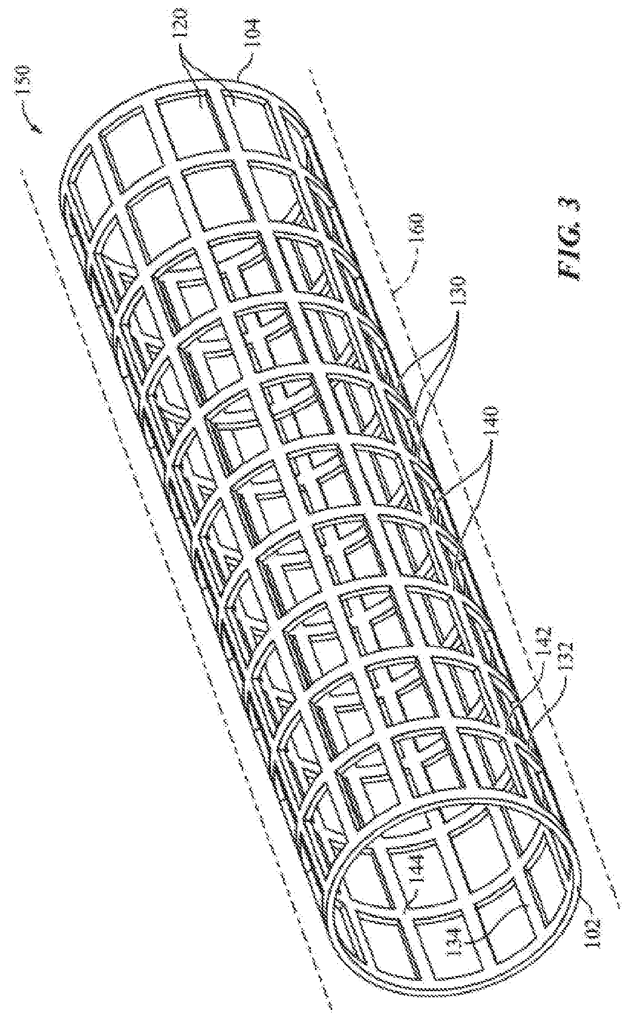 Stent with a smooth surface in its expanded configuration