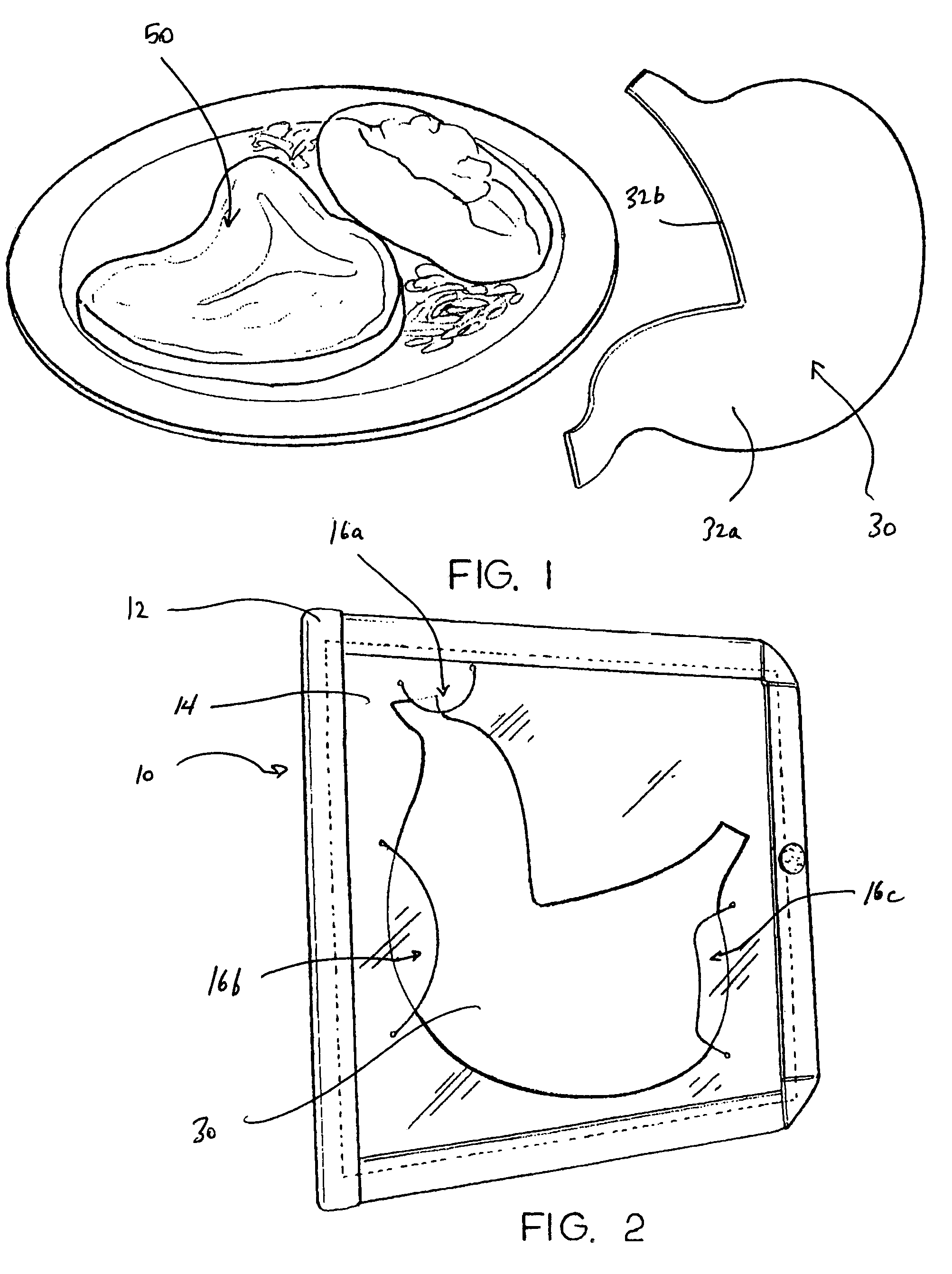 Stomach model visual dieting aid and method of use