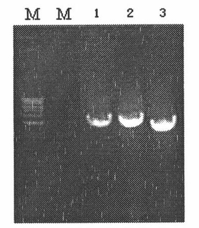 Method for producing periplaneta americana allergen protein Per a 5 in baculovirus-insect expression system