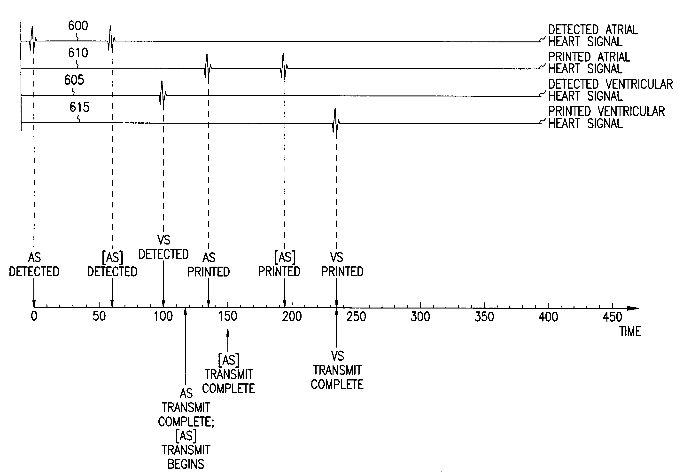 Event marker alignment by inclusion of event marker transmission latency in the real-time data stream