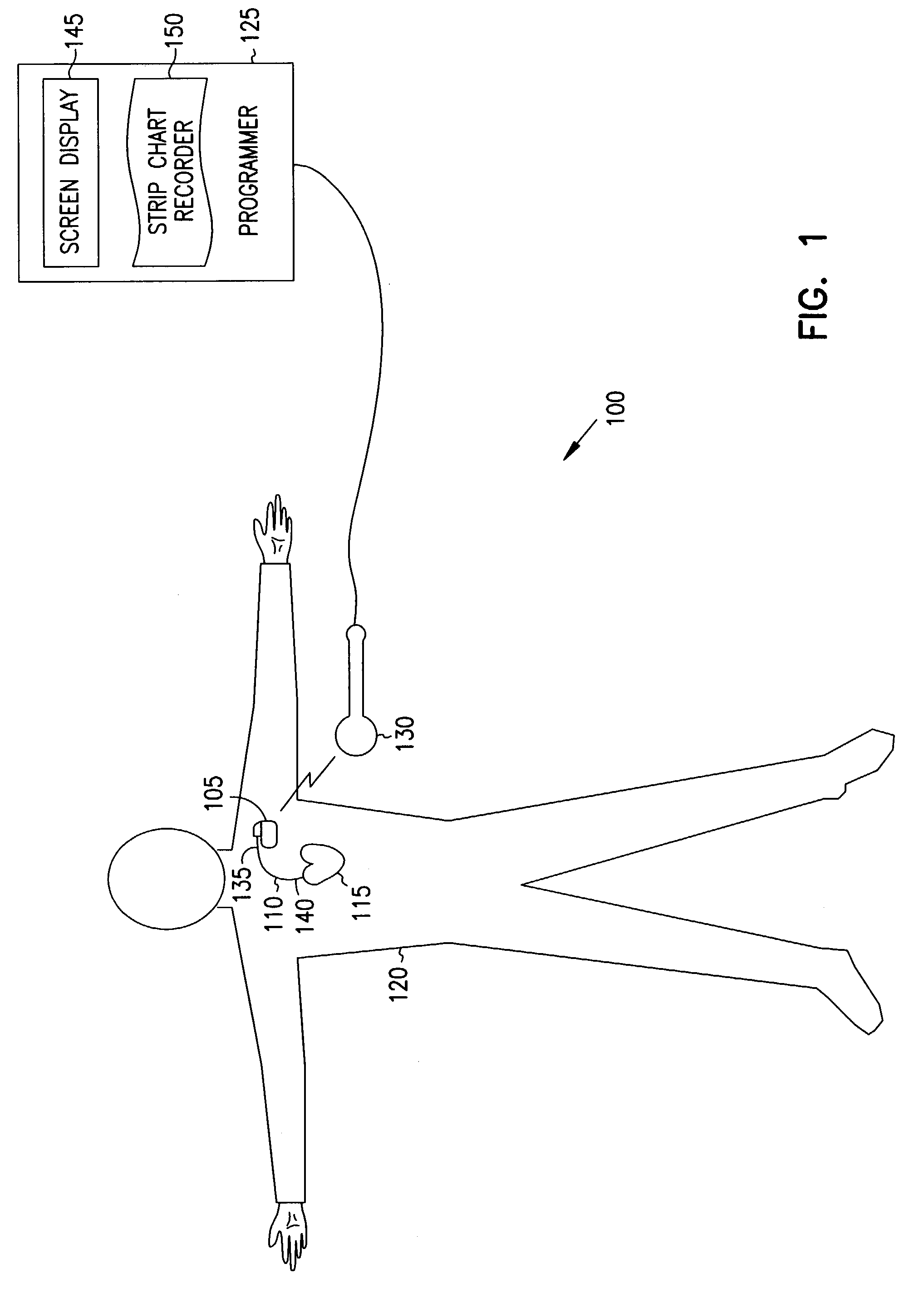 Event marker alignment by inclusion of event marker transmission latency in the real-time data stream