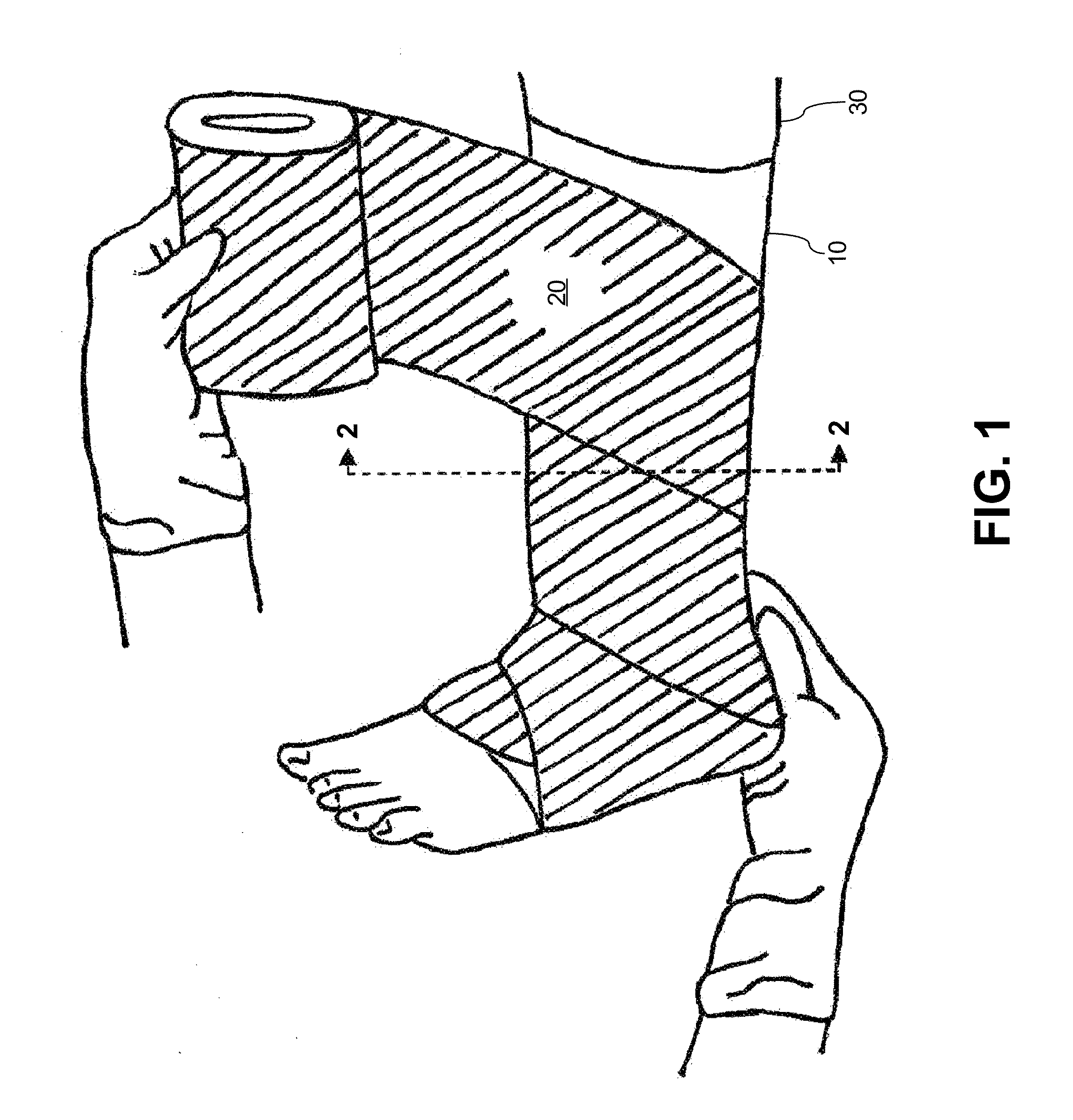 System and method for treating leg ulcers