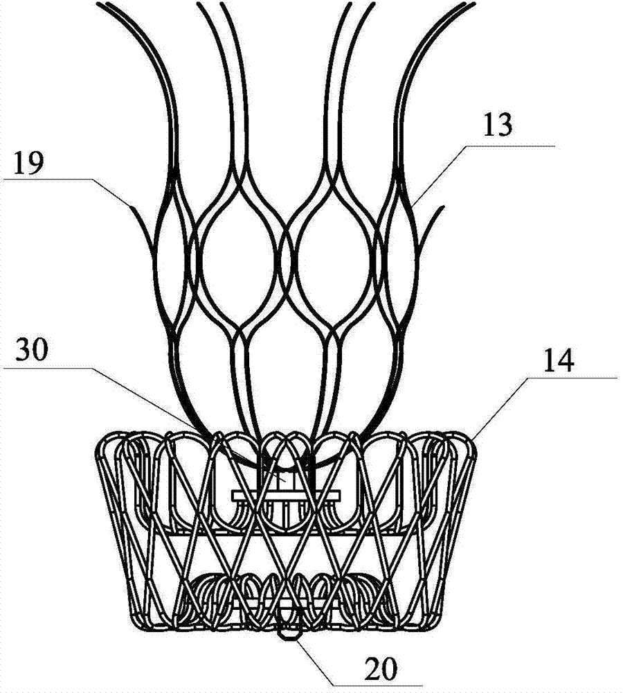 Left ventricle volume reduction device