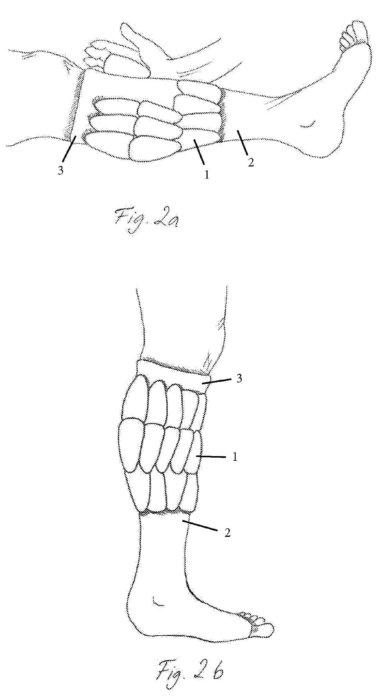 A Kit And Therapeutic Pressure Assembly With Patches For Applying Pressure To A Limb Or Other Body Part
