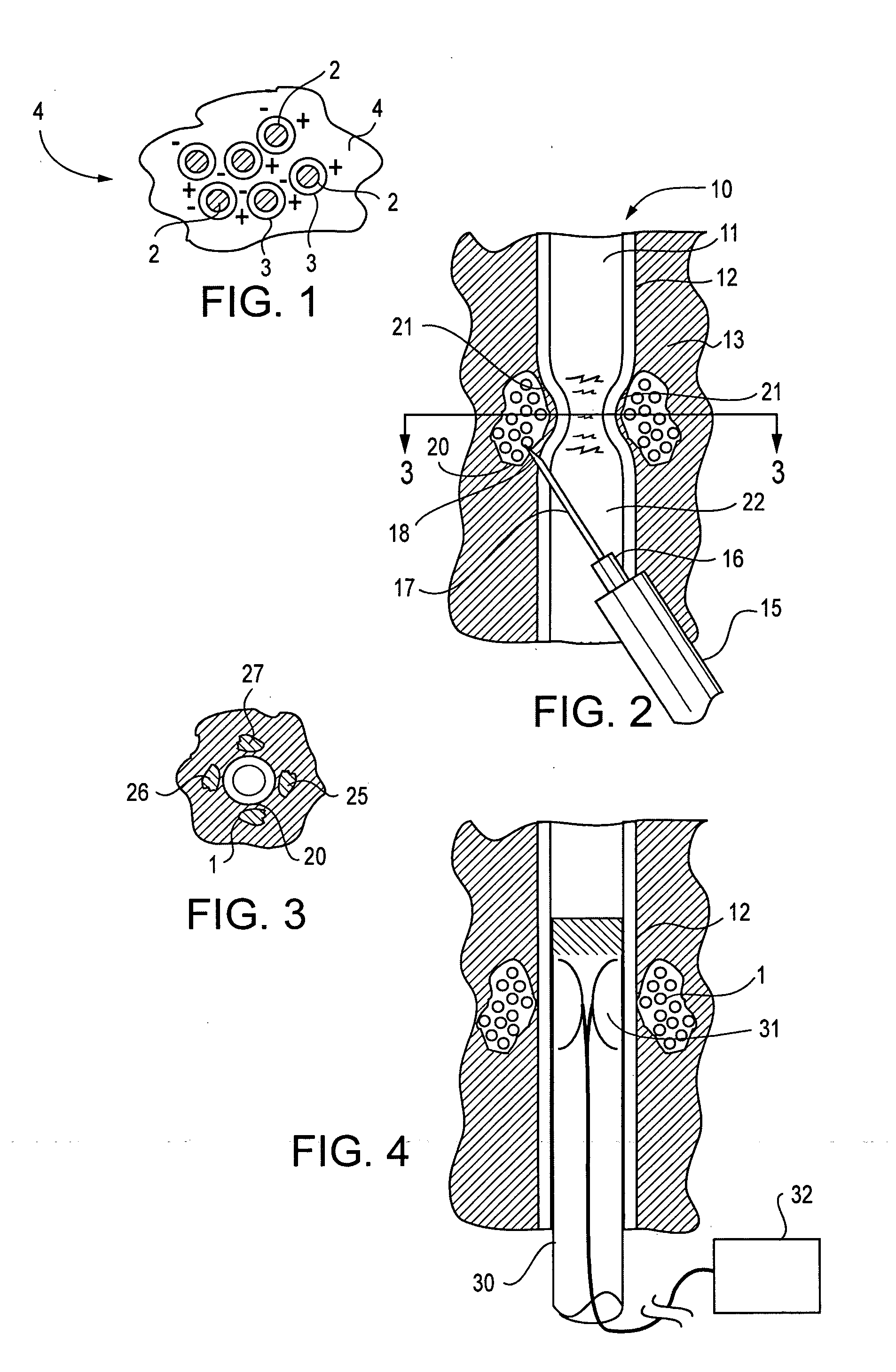 Active tissue augmentation materials and method