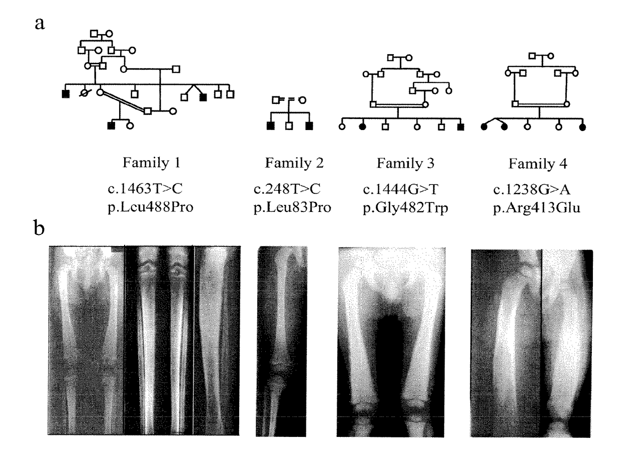 Methods for the treatment and diagnosis of bone mineral density related diseases