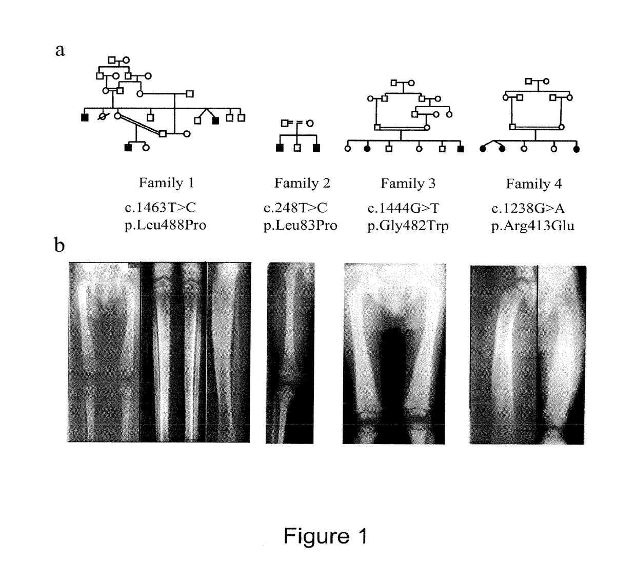 Methods for the treatment and diagnosis of bone mineral density related diseases