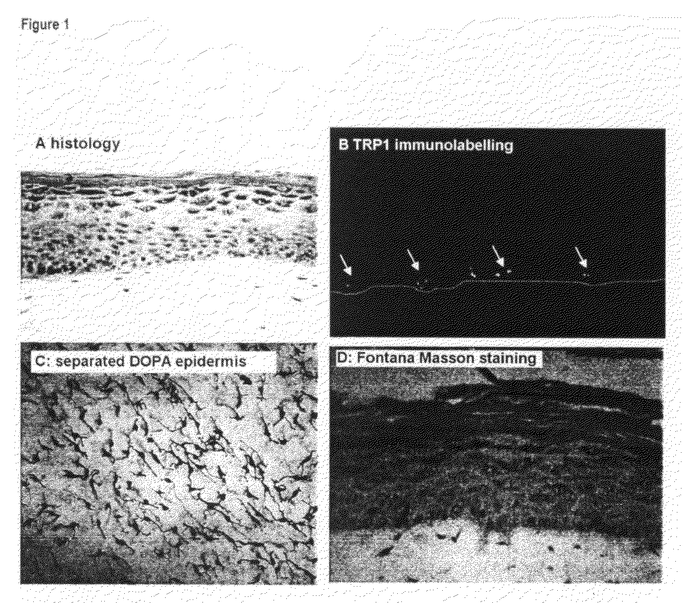 Functional pigmented skin equivalent