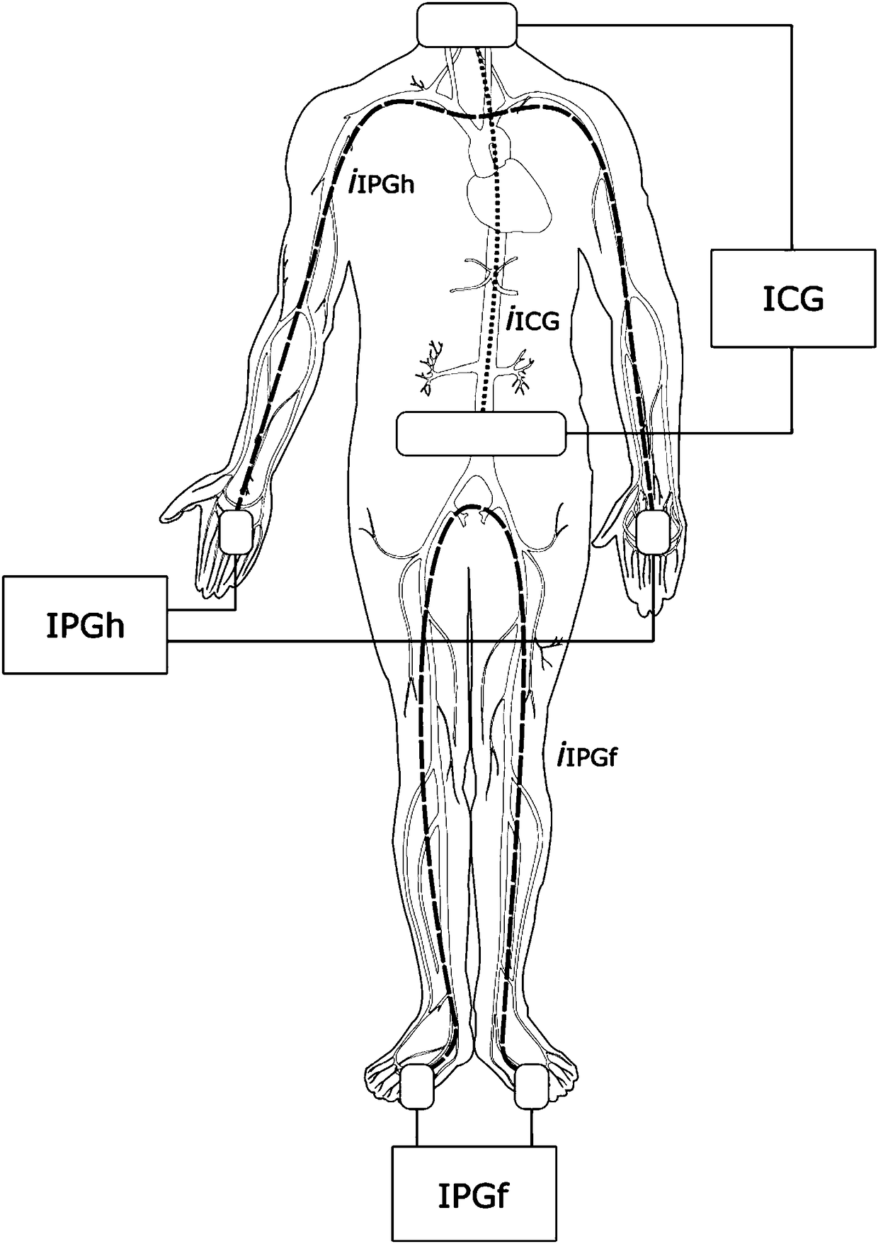 Method and device for estimating the transit time of the arterial pulse from measurements obtained in distal zones of the extremities