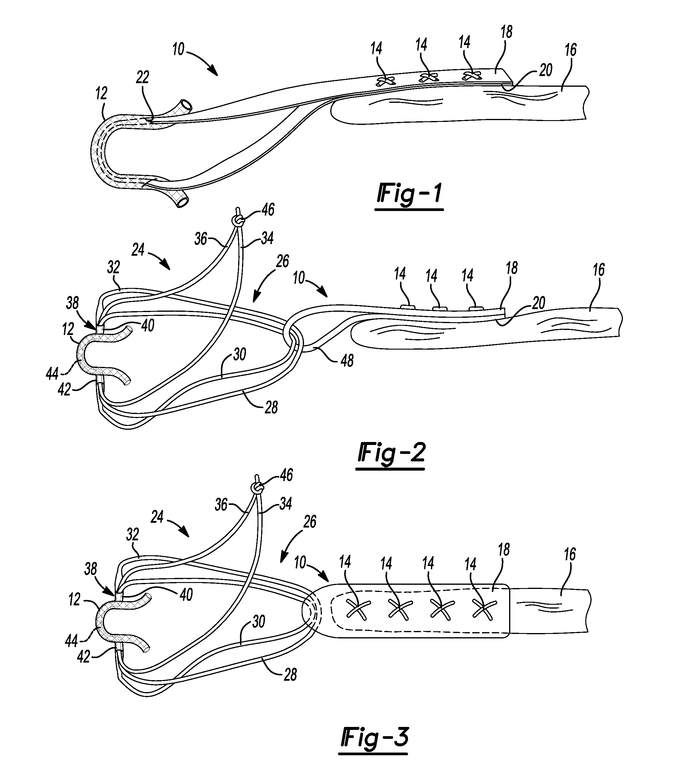 Method And Apparatus For Stitching Tendons