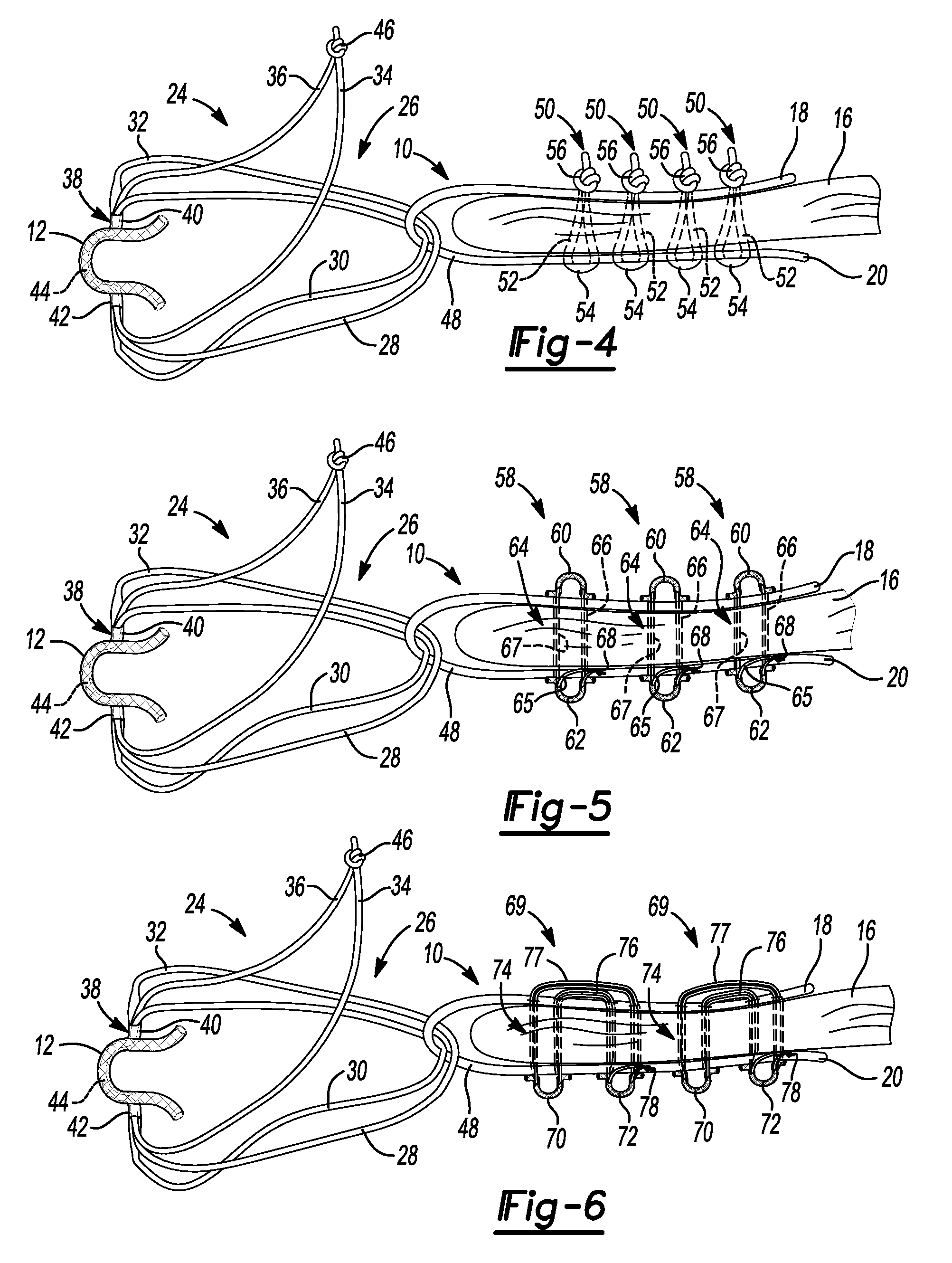Method And Apparatus For Stitching Tendons