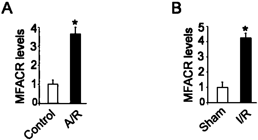 A kind of pharmaceutical composition targeting circRNA and its application