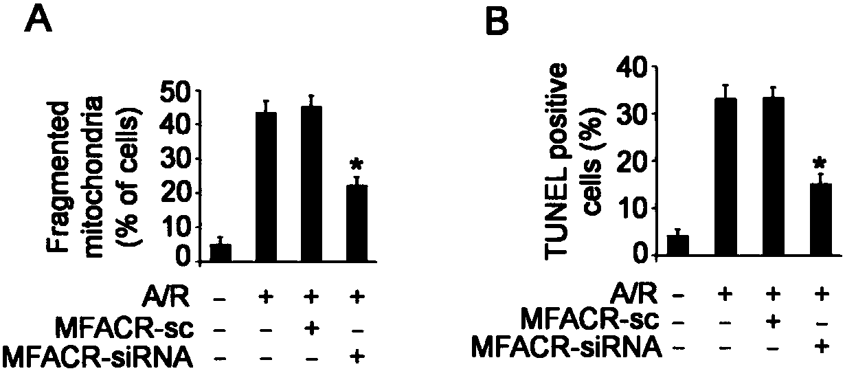 A kind of pharmaceutical composition targeting circRNA and its application