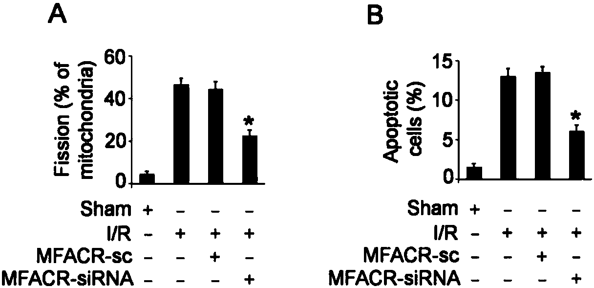 A kind of pharmaceutical composition targeting circRNA and its application