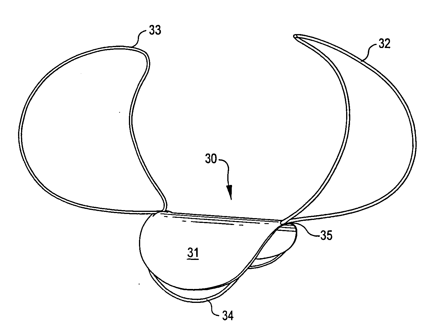 Implantable aneurysm closure systems and methods