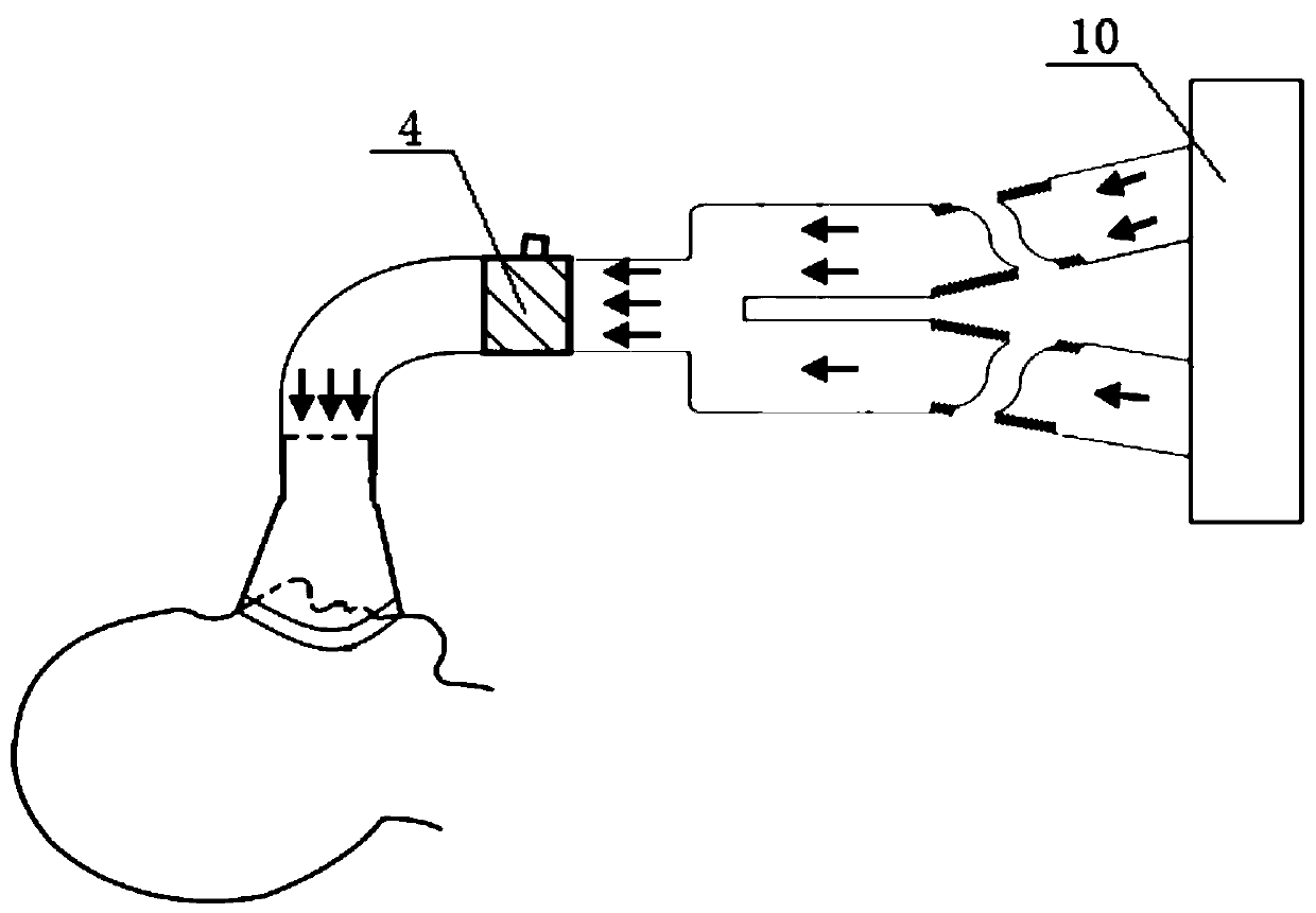 Loop type anesthesia ventilation system