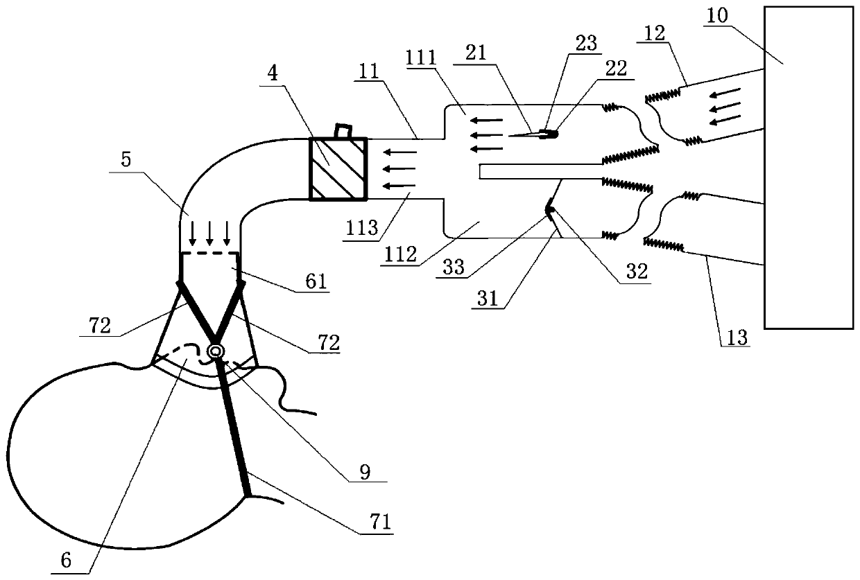 Loop type anesthesia ventilation system