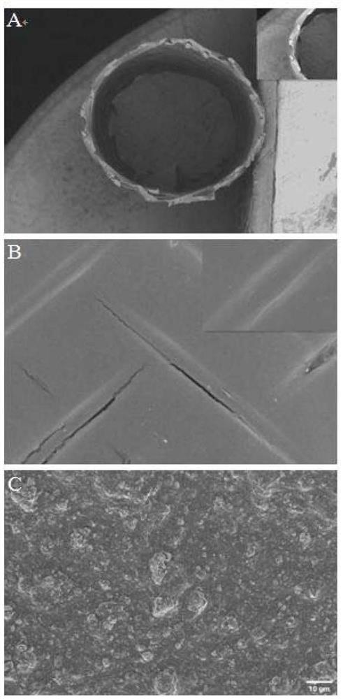 A long-acting antibacterial and anti-stenosis functional urethral stent and its preparation method