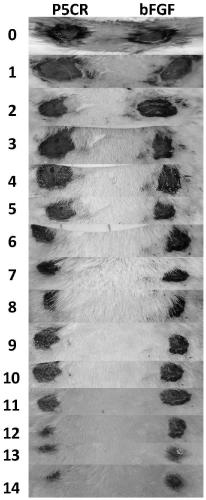 Application of human pyrroline-5-carboxylate reductase in preparation of drugs for treating skin wounds