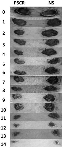 Application of human pyrroline-5-carboxylate reductase in preparation of drugs for treating skin wounds