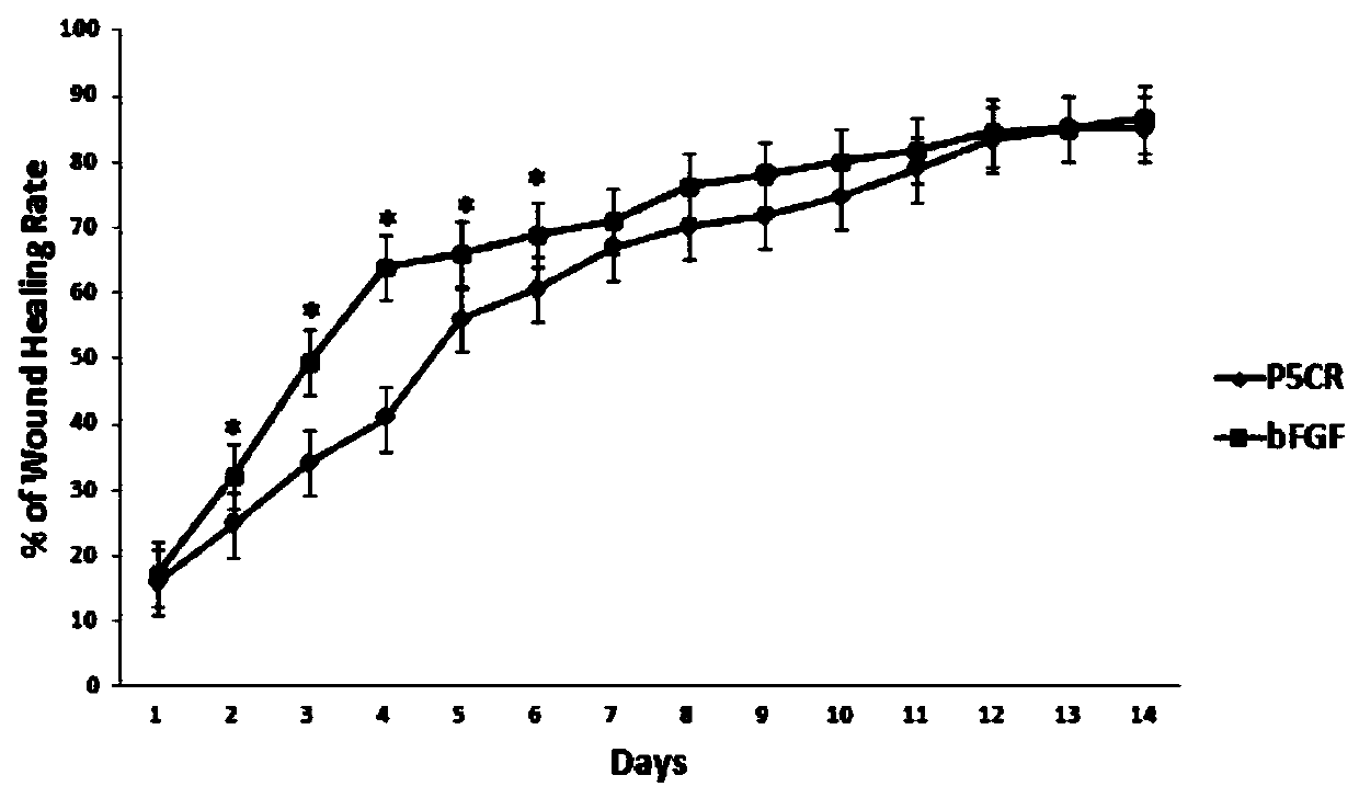 Application of human pyrroline-5-carboxylate reductase in preparation of drugs for treating skin wounds