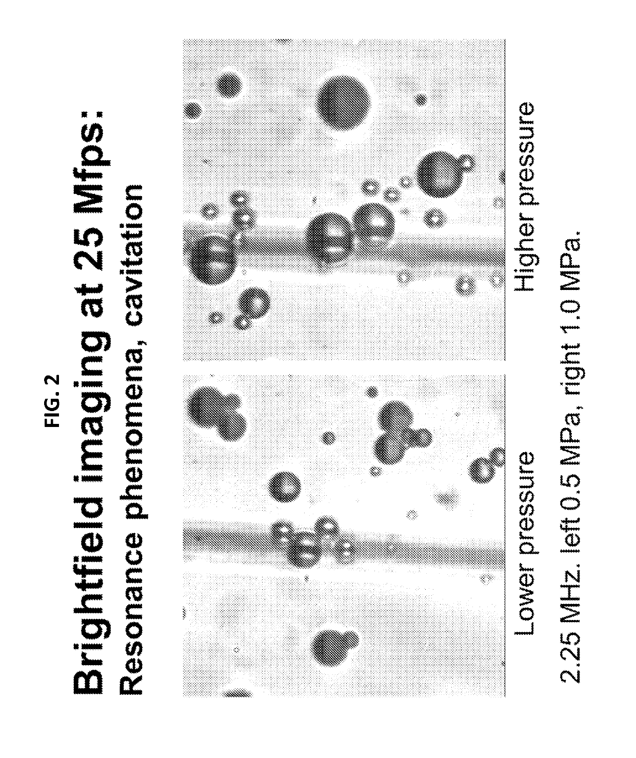 Methods and devices for ultrasound contrast-assisted therapy