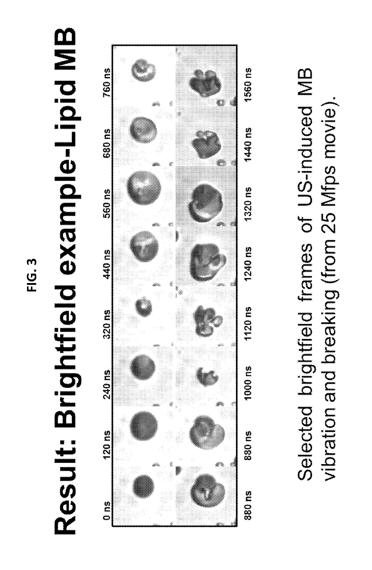 Methods and devices for ultrasound contrast-assisted therapy