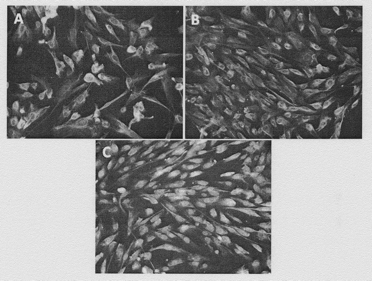 Preparation method and product of fibroblasts for skin scar repair