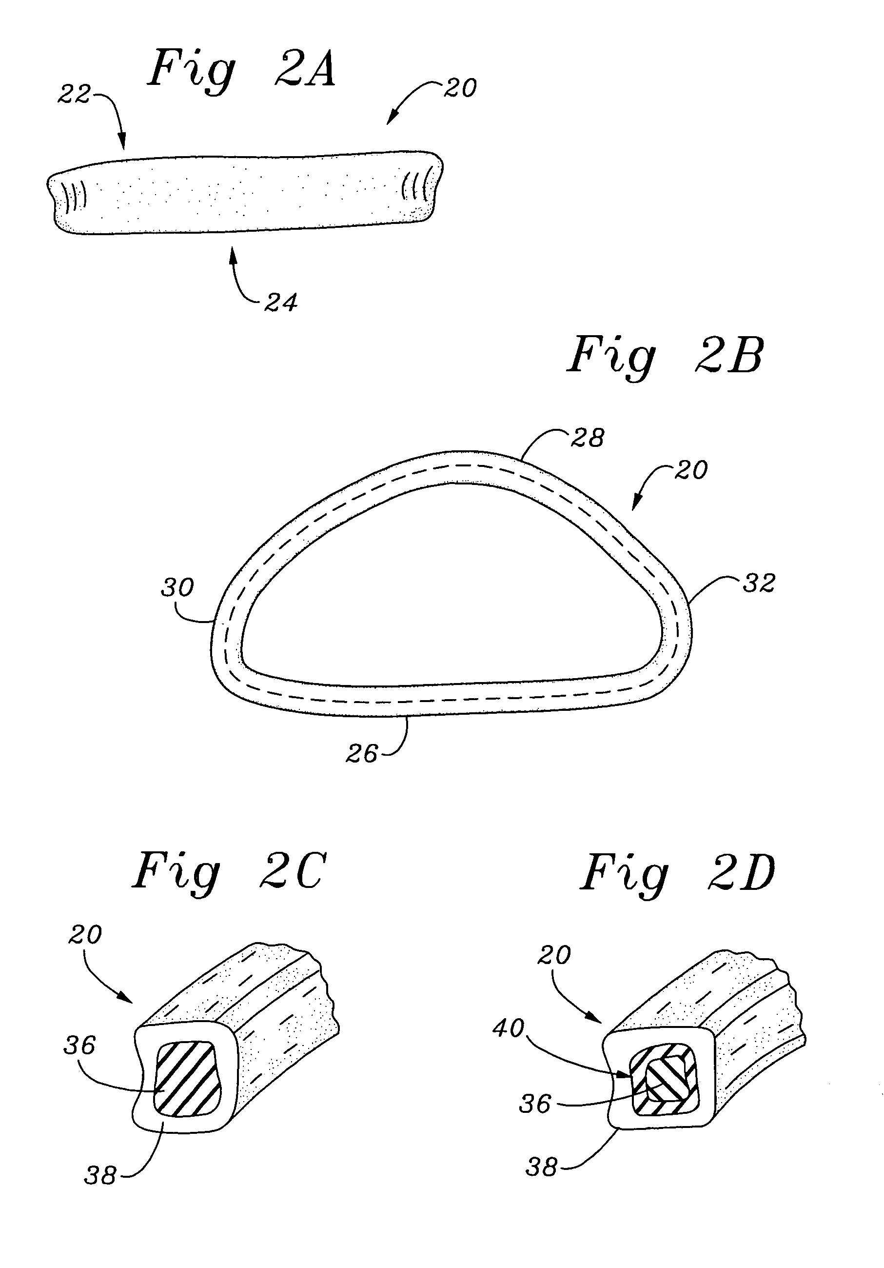 Method of implanting a self-molding annuloplasty ring