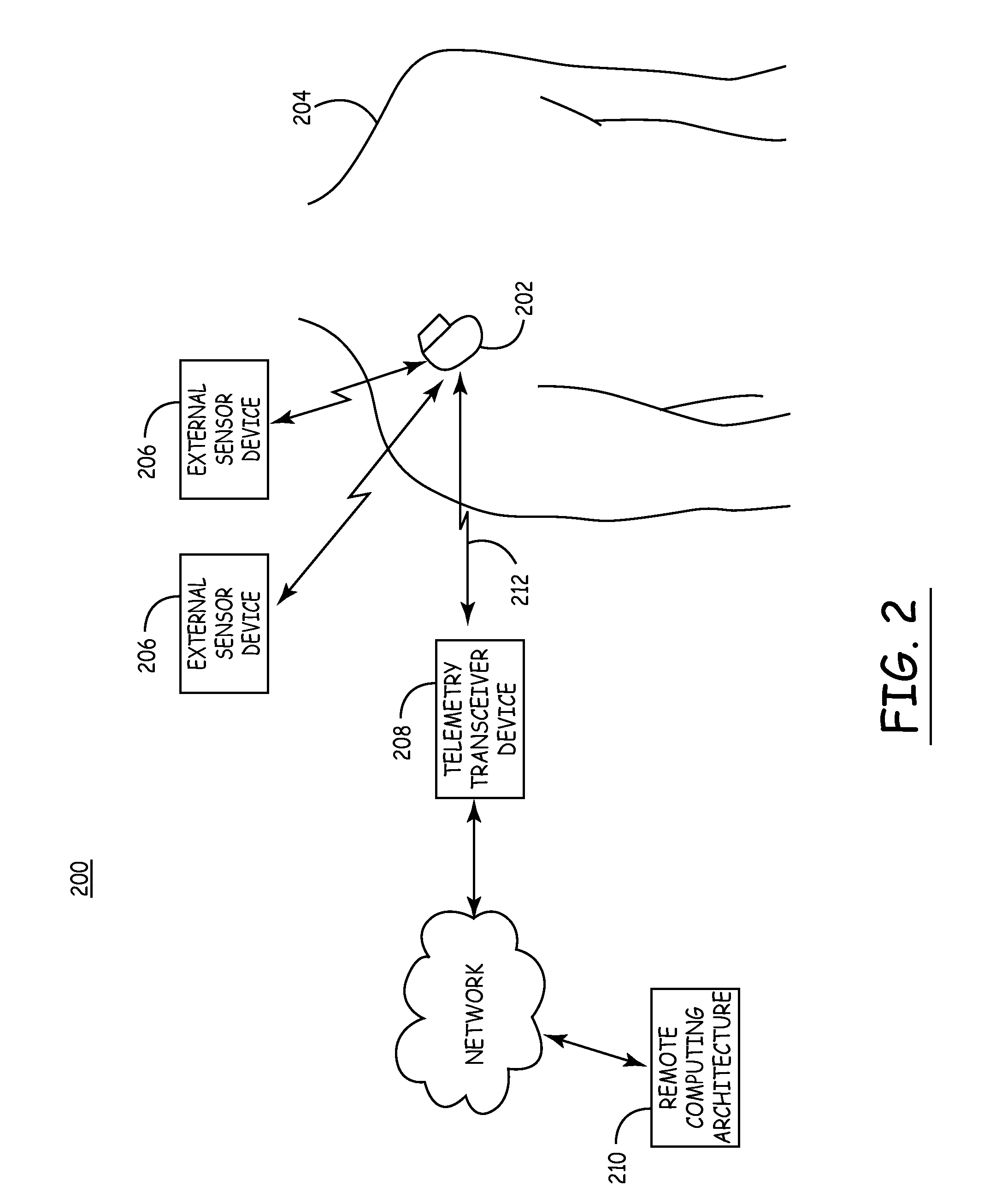 Telemetry of external physiological sensor data and implantable medical device data to a central processing system