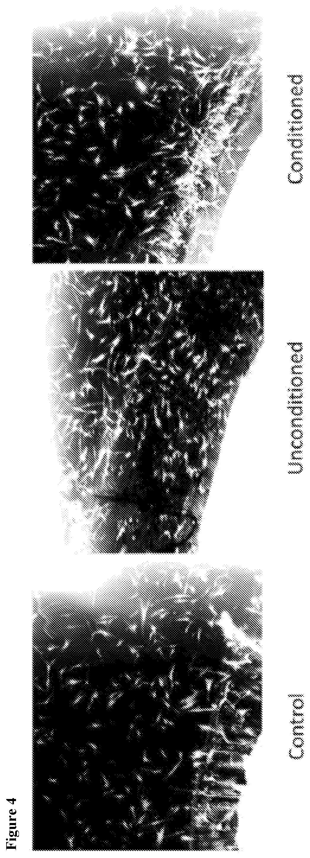 Biocompatible conditioned cell medium compositions and uses thereof