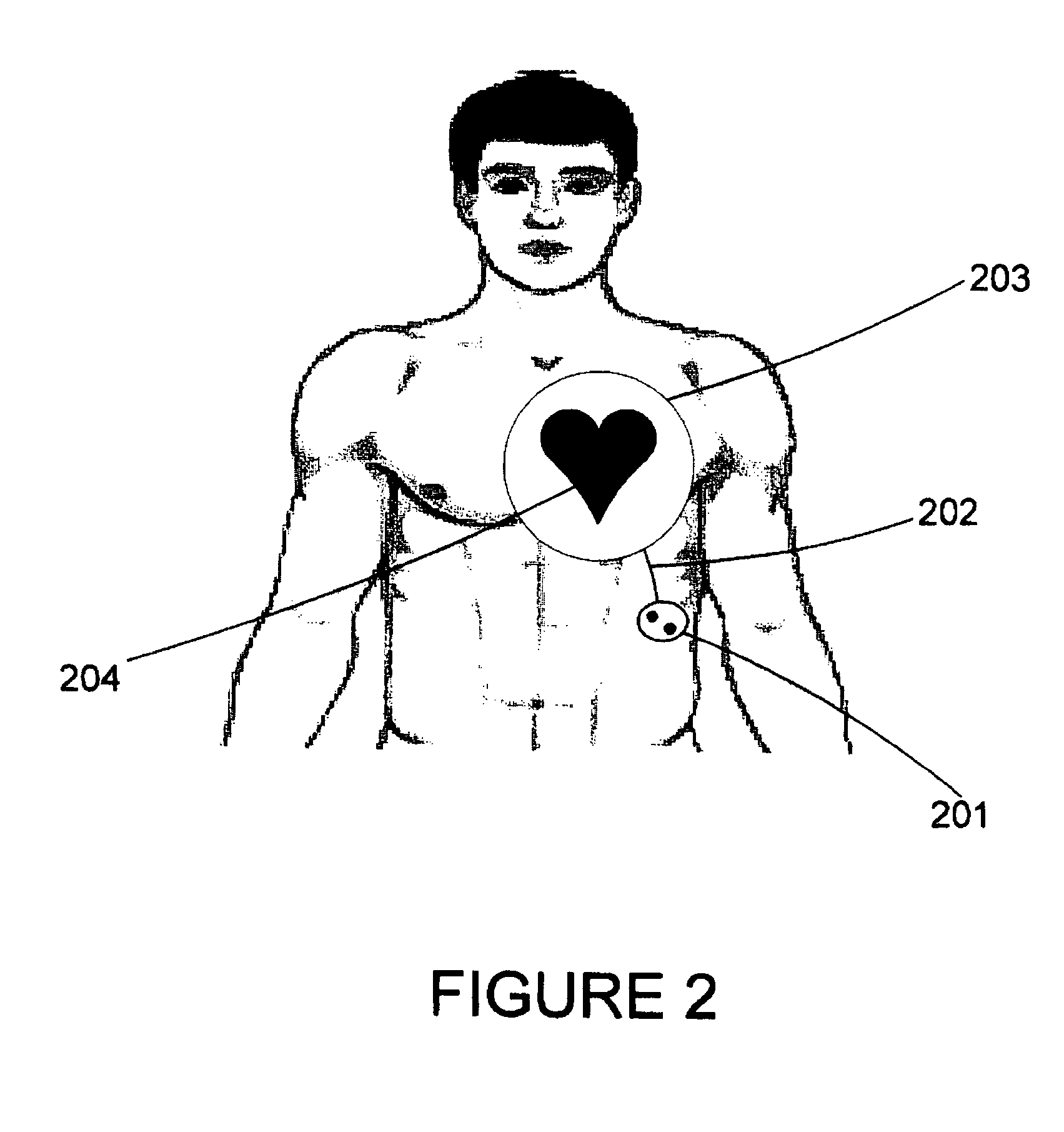 Electromagnetic treatment apparatus and method for angiogensis modulation of living tissues and cells